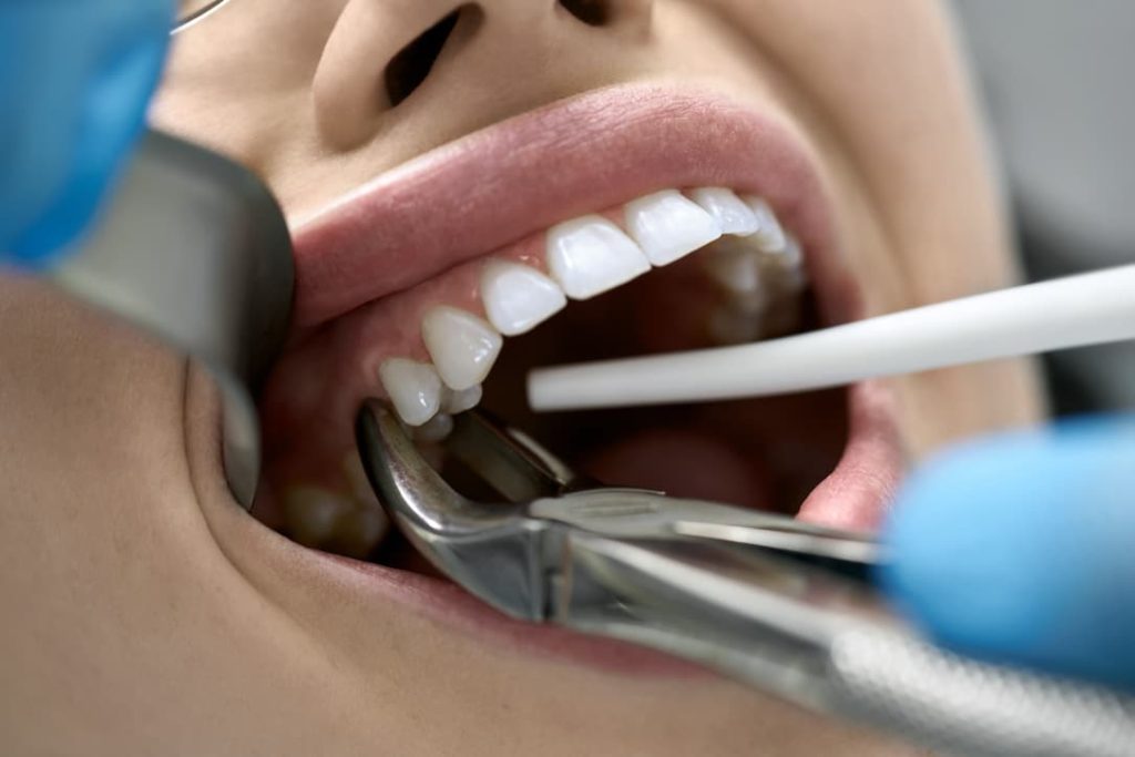 Dental Care